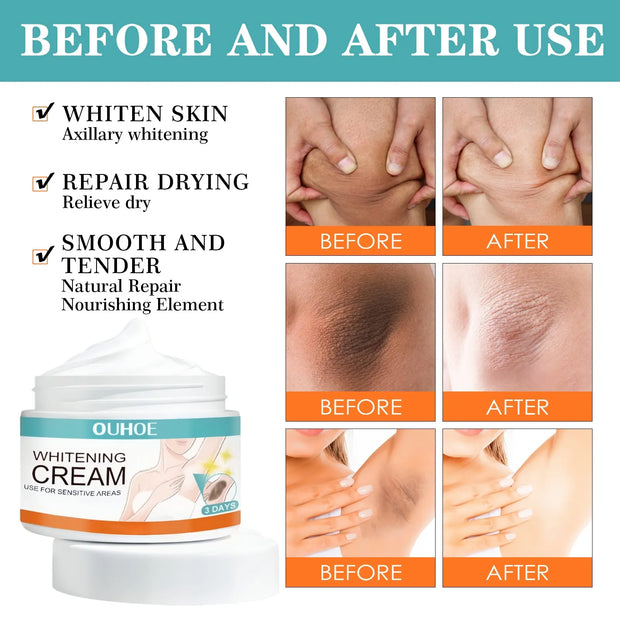 Private Parts Whitening Cream